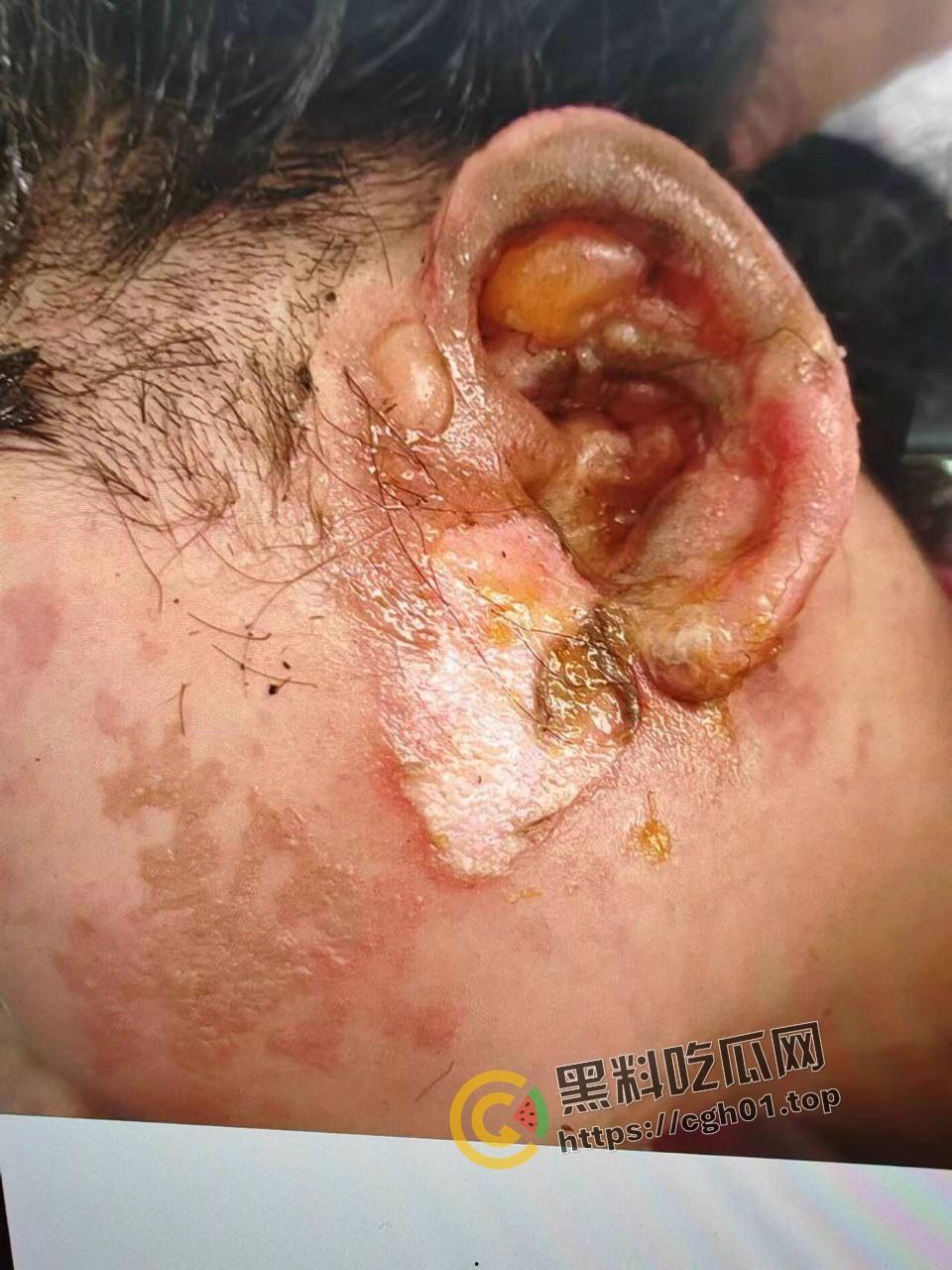 北京马坊镇放火杀人案 犯人【刘峰强】被抓 受害人全身烧烂 手臂被砍 全家老小失去人形 惨不忍睹 血腥慎点-5