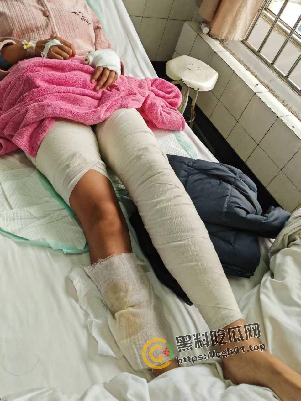 北京马坊镇放火杀人案 犯人【刘峰强】被抓 受害人全身烧烂 手臂被砍 全家老小失去人形 惨不忍睹 血腥慎点-7