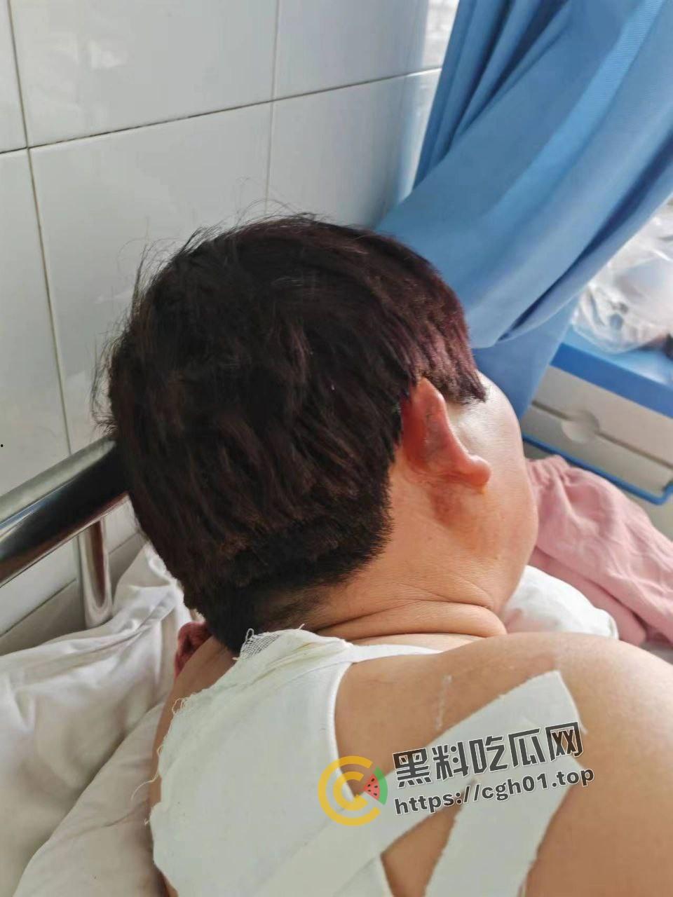 北京马坊镇放火杀人案 犯人【刘峰强】被抓 受害人全身烧烂 手臂被砍 全家老小失去人形 惨不忍睹 血腥慎点-10