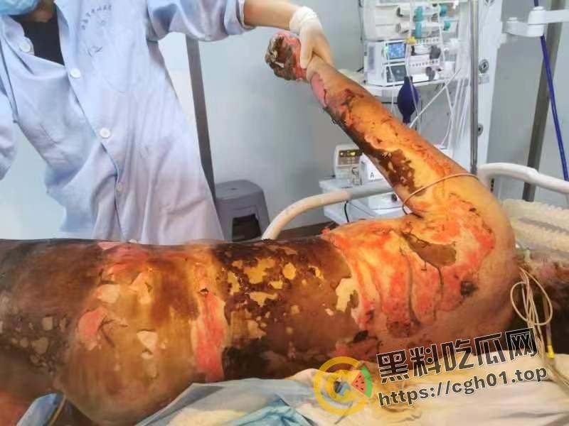 北京马坊镇放火杀人案 犯人【刘峰强】被抓 受害人全身烧烂 手臂被砍 全家老小失去人形 惨不忍睹 血腥慎点-14