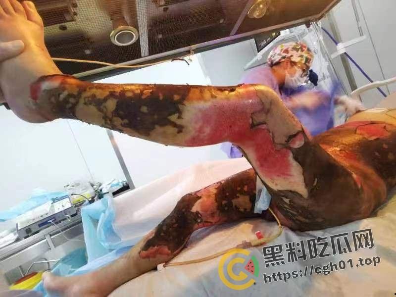 北京马坊镇放火杀人案 犯人【刘峰强】被抓 受害人全身烧烂 手臂被砍 全家老小失去人形 惨不忍睹 血腥慎点-15