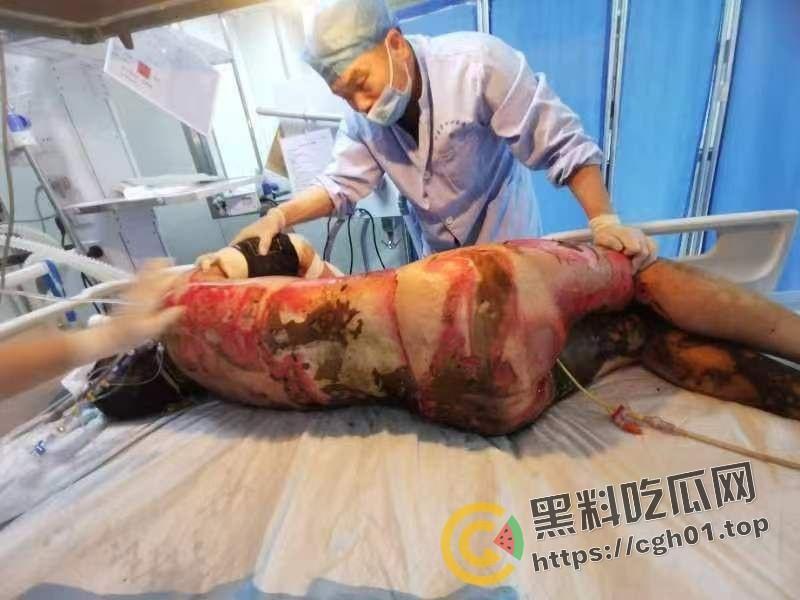 北京马坊镇放火杀人案 犯人【刘峰强】被抓 受害人全身烧烂 手臂被砍 全家老小失去人形 惨不忍睹 血腥慎点-18