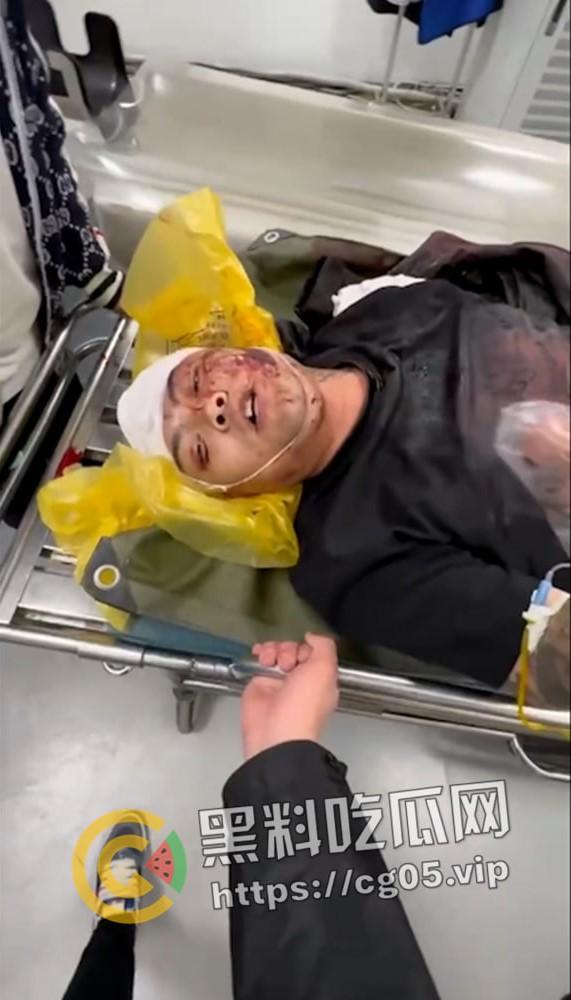 精神小伙哈尔滨斯卡拉迪厅前挑衅!上一秒嚣张至极 下一秒被打成猪头 活该-6