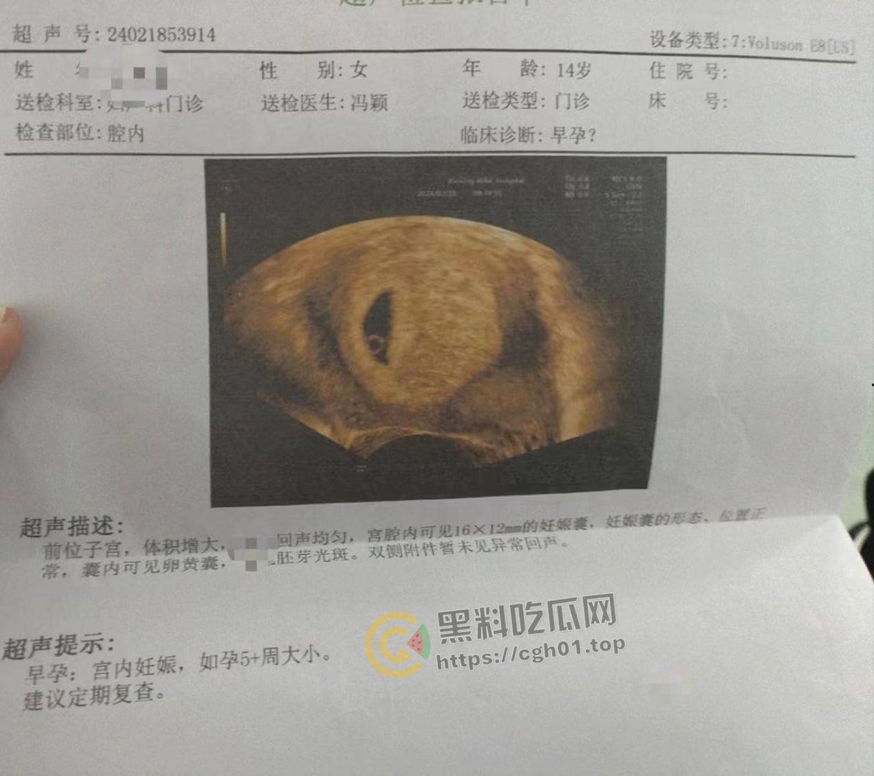 初中生小畜生【黄明昊】把女朋友搞怀孕 逆天发言生出来就踹死