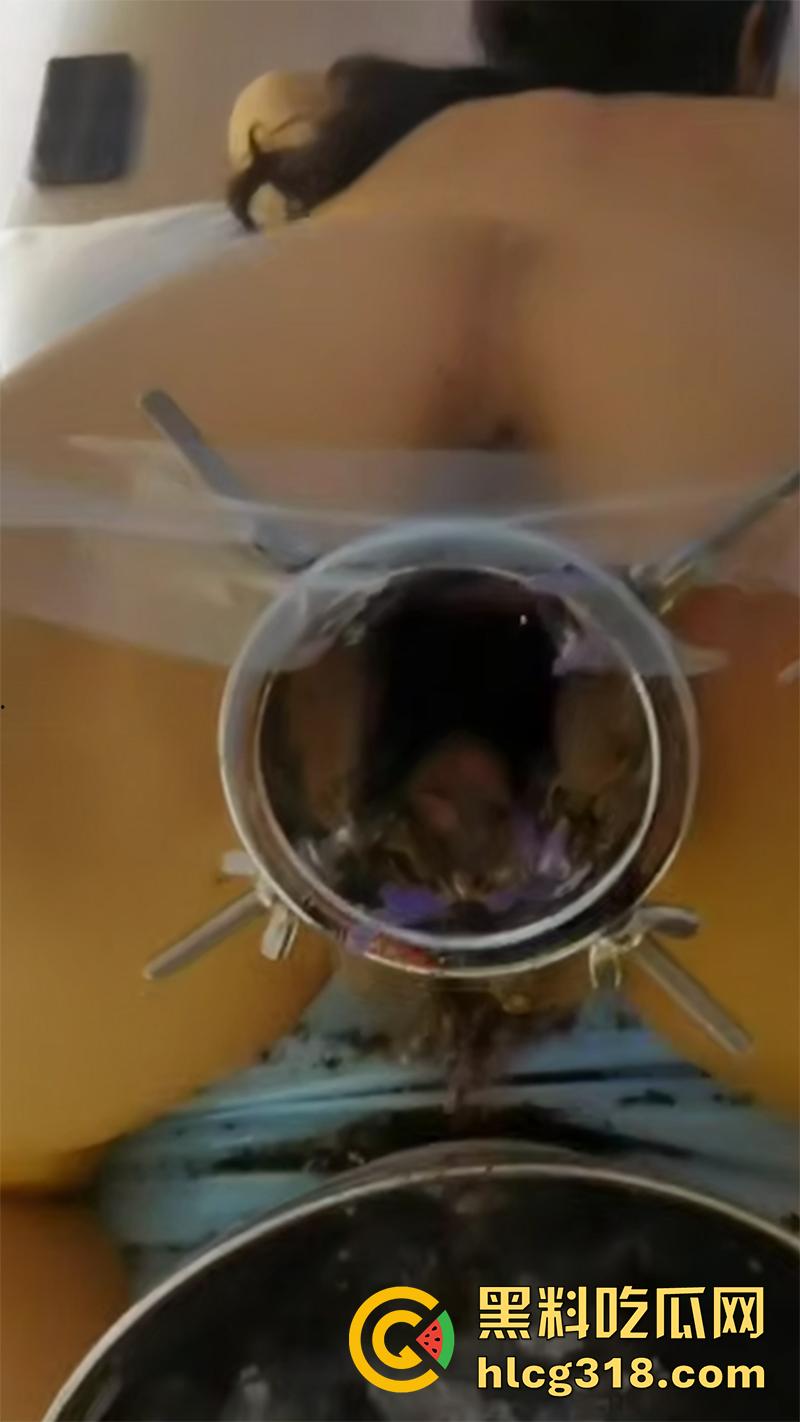 重口极限引导扩张虐穴，逼里塞图钉钢管插子宫口，鸡巴爆插尿道操的骚逼白浆四溢，宫颈真像个鱼唇！-6