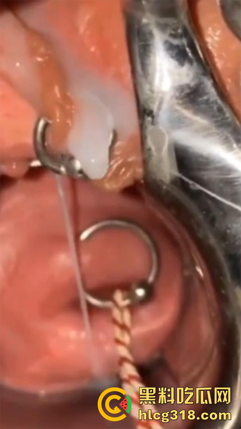 重口极限引导扩张虐穴，逼里塞图钉钢管插子宫口，鸡巴爆插尿道操的骚逼白浆四溢，宫颈真像个鱼唇！-7