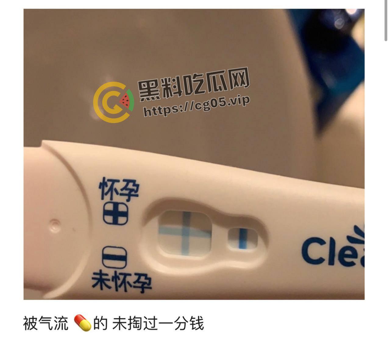 上海鸭王【闫啸天】和鸡婆的狗血爱情故事!鸭王性病 偷吃打鸡婆打到流产 属于是烂人比烂 家暴现场血腥画面流出-5