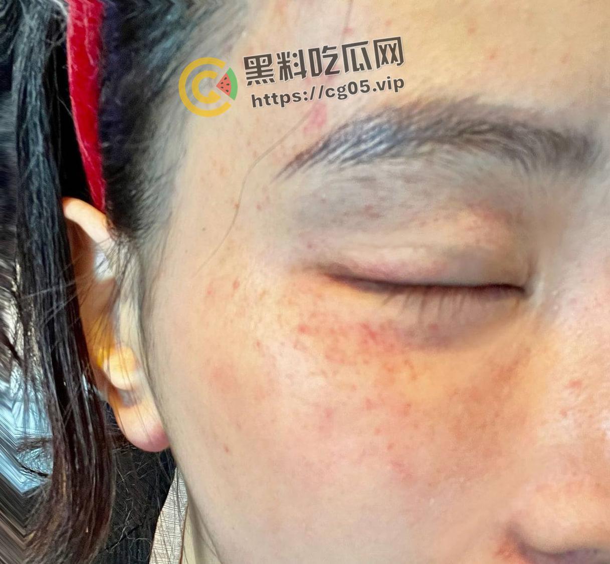 上海鸭王【闫啸天】和鸡婆的狗血爱情故事!鸭王性病 偷吃打鸡婆打到流产 属于是烂人比烂 家暴现场血腥画面流出-10