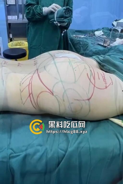 现在妹子为美疯魔抽脂隆奶塞逼艾灸,骚穴子宫烤得喷香,医美变态到艾灸鸡巴都出现了!-10