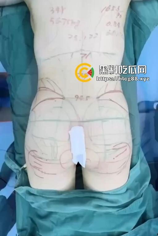 现在妹子为美疯魔抽脂隆奶塞逼艾灸,骚穴子宫烤得喷香,医美变态到艾灸鸡巴都出现了!-11