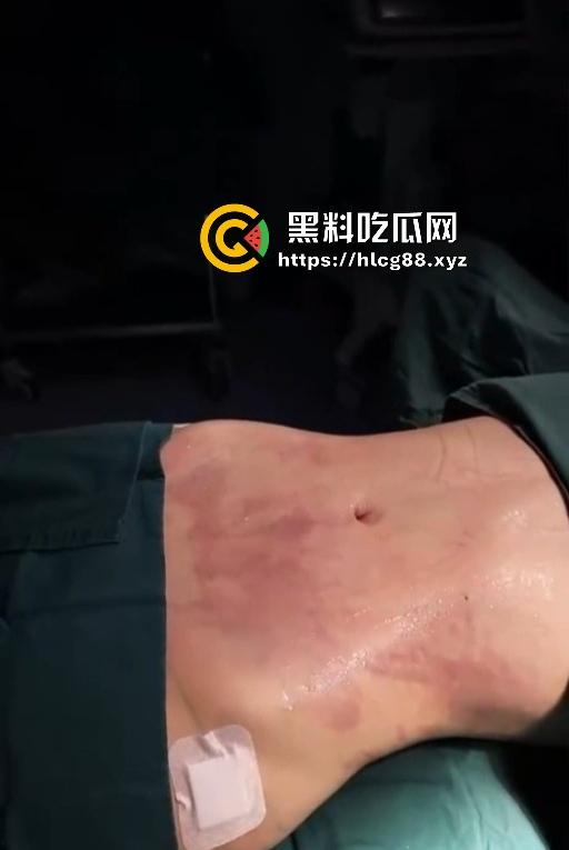 现在妹子为美疯魔抽脂隆奶塞逼艾灸,骚穴子宫烤得喷香,医美变态到艾灸鸡巴都出现了!-12