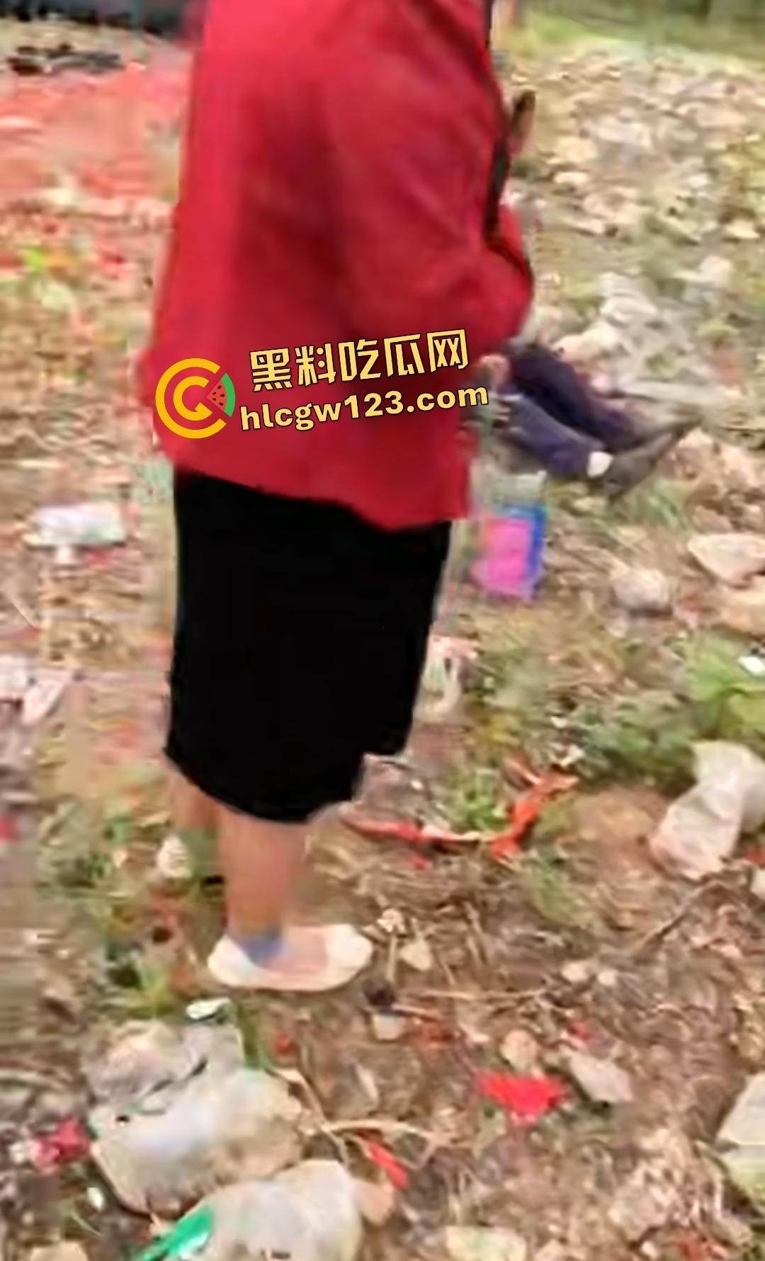 河南平顶山鲁山王大爷捡烟花炸头变黑鬼！右眼已瞎保不住，脑子里有骨头渣！