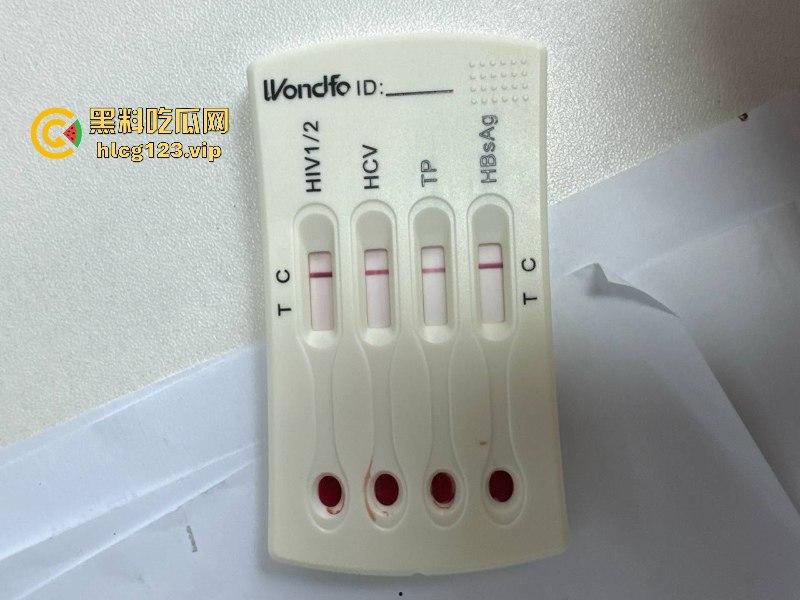 可怕！为了报复社会把带血针头扎进了共享单车的座椅里……山东商业技师学校20个被感染艾滋！！！-9