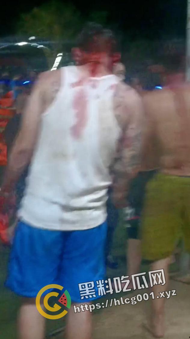 海南海口大致坡大陆人大战海南人 摸了本地人老婆地屁股 命就得留下 现场视频流出 真下死手-4