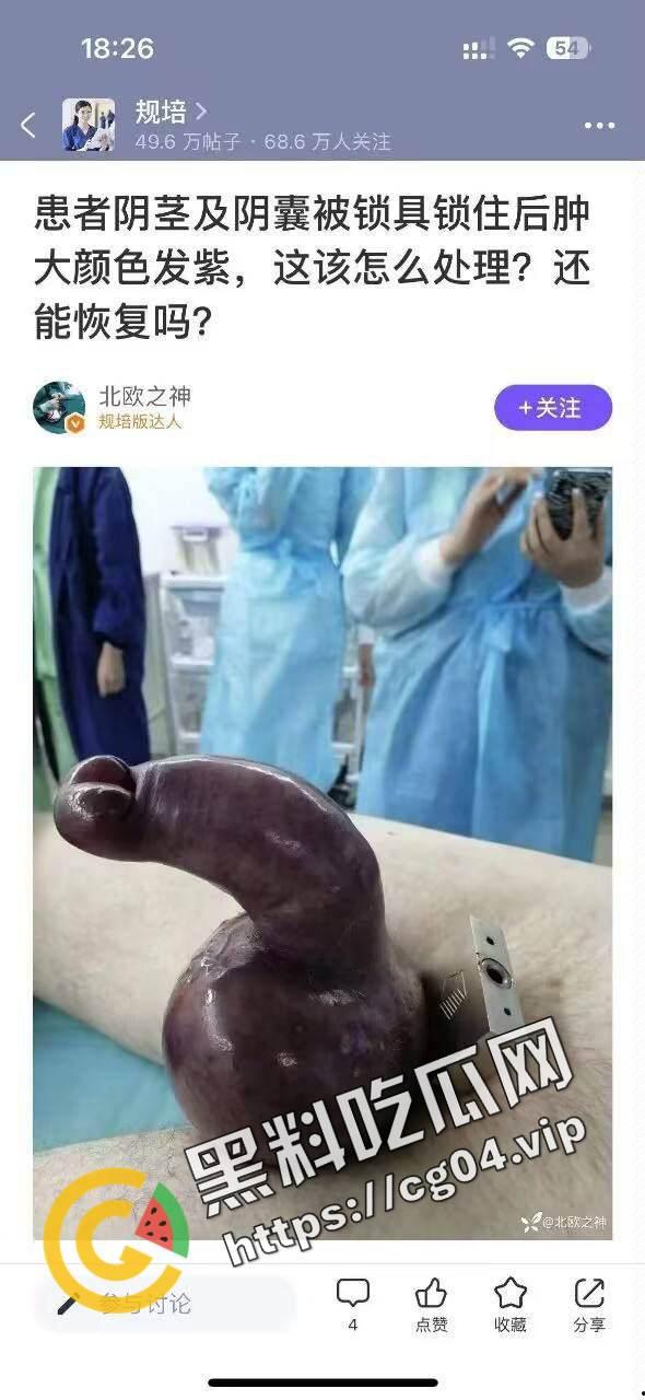 玩的花不是叫你玩命!w外国男子阳具被锁肿成大蒜一样 医生都束手无策-1