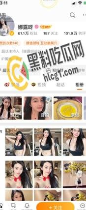 抖音 快手 微博 三栖网红「娜露呀」真正土豪福利流出 微密圈弱爆了！-1