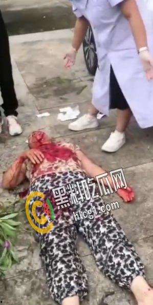 畜生行为!浙江海宁市周王庙镇 畜生孙子为了一个西瓜爆打奶奶 把奶奶打到浑身是血 倒地不起-5