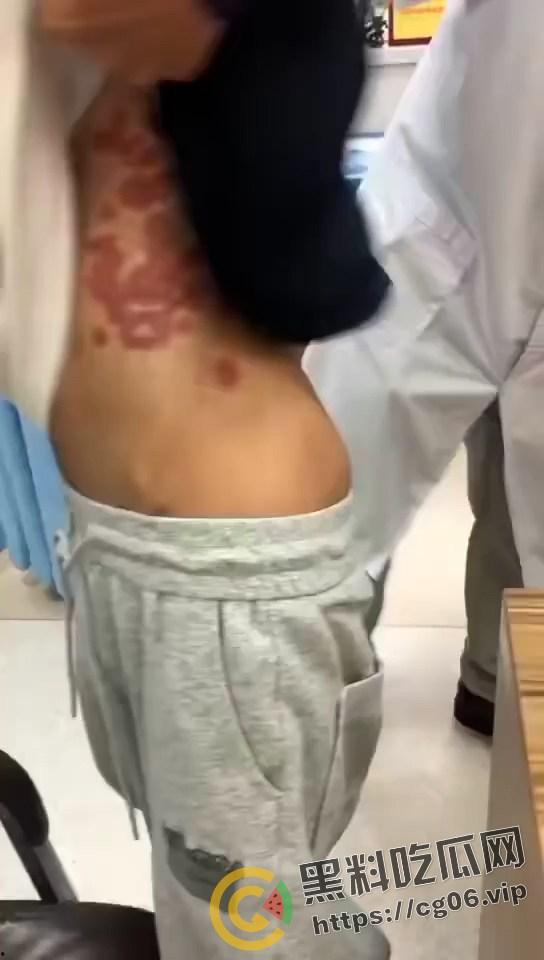 初三学生化身毒王 梅毒三期 艾滋 浑身腐烂 牛子流脓 还说自己没有过性生活 检查现场视频曝光-1