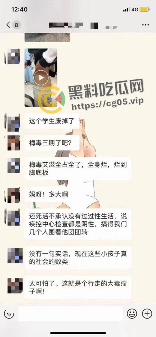 初三学生化身毒王 梅毒三期 艾滋 浑身腐烂 牛子流脓 还说自己没有过性生活 检查现场视频曝光-5