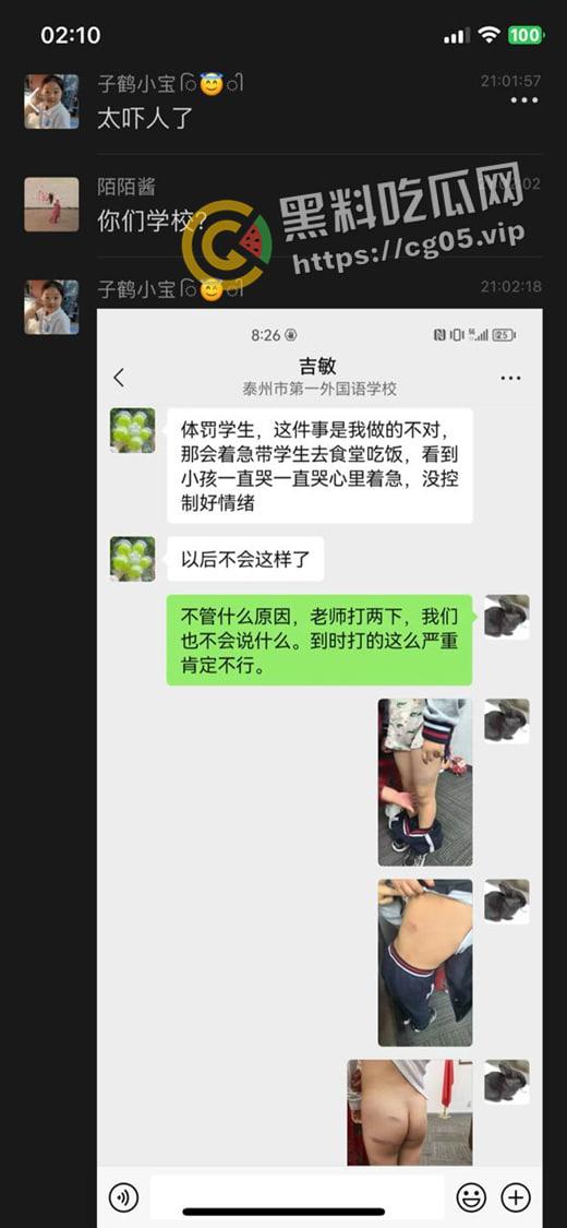 泰州外国语小学老师暴打小学生 全身淤青 家长群内声讨被解散 至今无说法-11