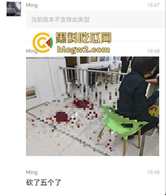 毕业证拿不到，实习费嫌少？21岁小伙持刀回母校发疯，无锡宜兴工艺学院8死17伤，一路无差别捅女生！-2