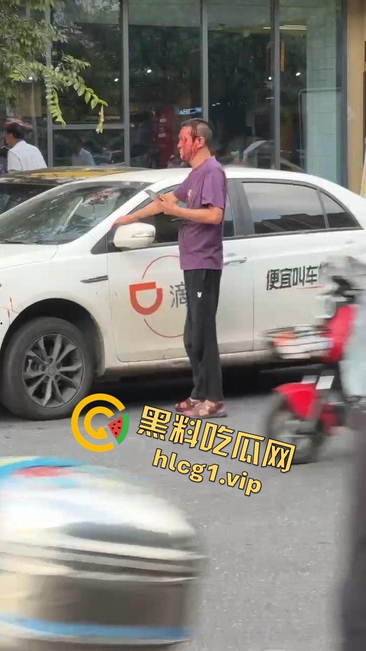 女子因价格争执叫来老公,掏出扳手开瓢,赔偿金额够买辆新车!-9