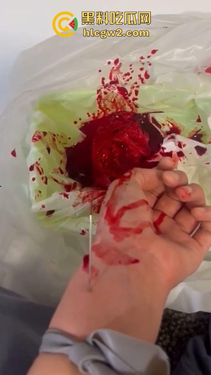 血腥慎入!推特十级脑残血腥自残自拍 残暴割腕引血自流 这是作死还是变态?-6