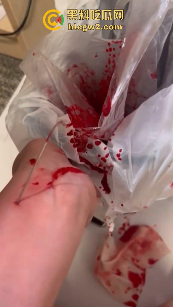 血腥慎入!推特十级脑残血腥自残自拍 残暴割腕引血自流 这是作死还是变态?-7