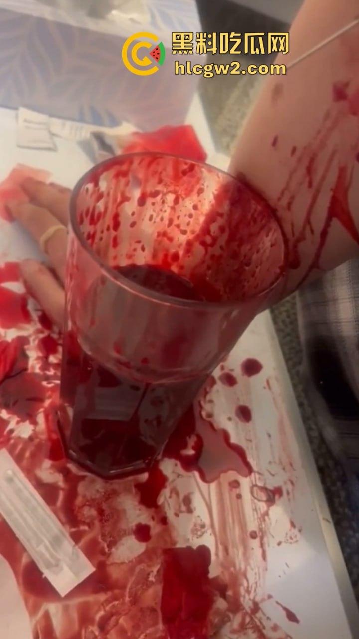 血腥慎入!推特十级脑残血腥自残自拍 残暴割腕引血自流 这是作死还是变态?-8